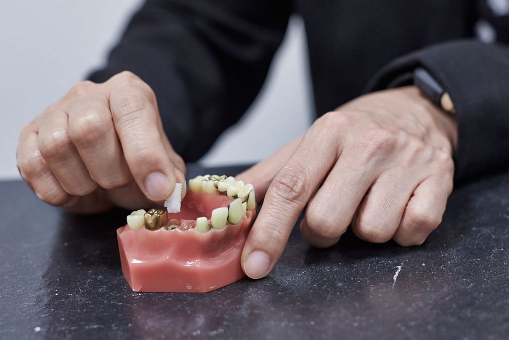 Projek kajian tumbuhkan tulang di ruang gigi tanggal bagi implan