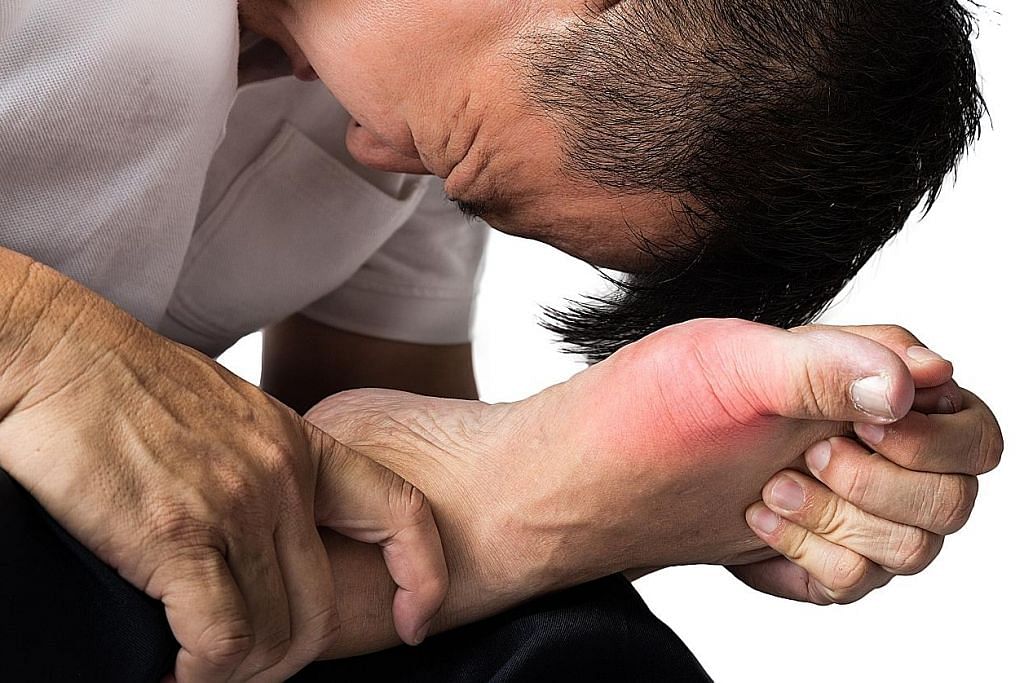 Gout: Simptom dan penyebab